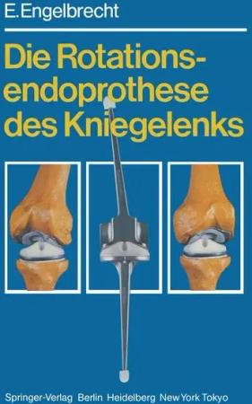 Die Rotationsendoprothese des Kniegelenks