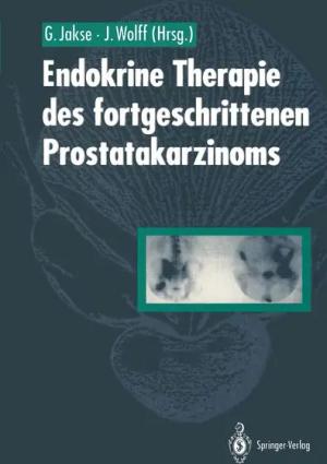 Endokrine Therapie des fortgeschrittenen Prostatakarzinoms