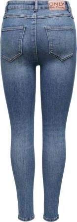 ONLY High-waist-Jeans Mila (1-tlg) Patches